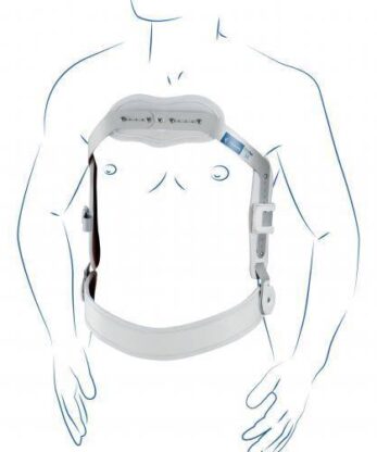 Drawing of a mannequin with back support called Jewett's Rigid Back Vest 35.